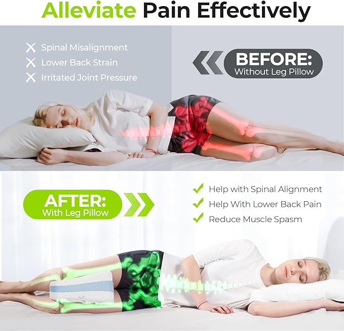 AUVON Leg & Knee Pillow for Sciatica, Back, HIPS, Joints Pain Relief, Enhanced Softness & Support Sandwhich Memory Foam Knee Pillow for Side Sleepers, Ice Silky Fabric for Sleeping Comfort